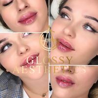 glossyaesthetics_uk