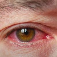 МИЛОХИН Я ДОМА x MEMORIZING