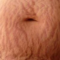 etrechisansvergeture