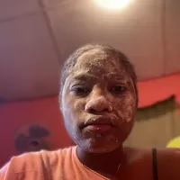 I Dey enter your eyes abi