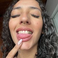 _fernandatozi