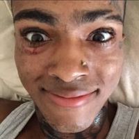 xxxtentacion5fan