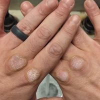 fistofthedogmedicine