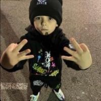 They took my f.ing eyes.