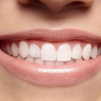 celebrity.teeth.color23