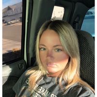 Tired eyes