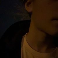 sprxrst_