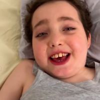 albertolerza