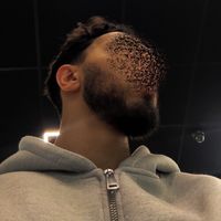 1connnnu