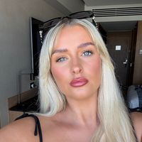 zararoseburnsx