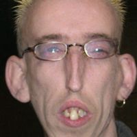 elbombonsolitario1