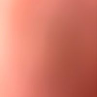 n___1772