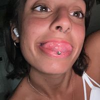 amyloccii