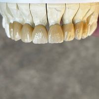 dentaltechniker