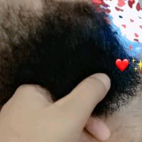 amsoheal