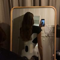 scoliosis._.girlx