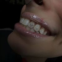 chronicallyonlinexo