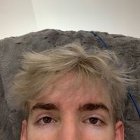 albertsinfectedtoesucker