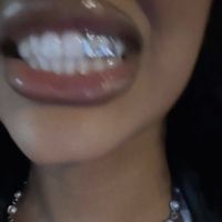 disturbia ADJL remix