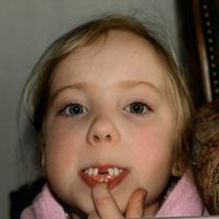 beautprincessdis0rder