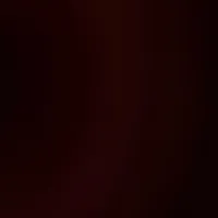 original sound - viillanelle