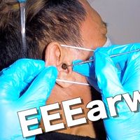 theearwaxspecialist